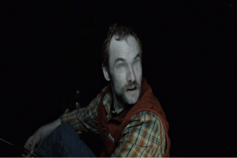 closeup of a man's face that shows he has been blinded